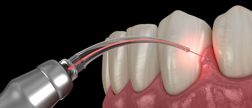 Dental Clinic Keelkattalai