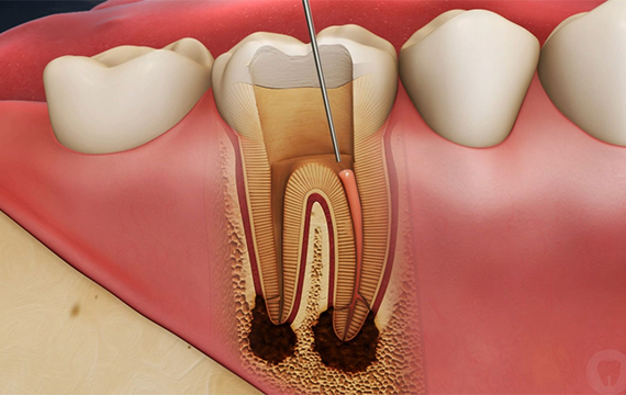 Top 10 Dental Hospital in Chennai