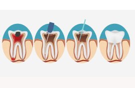 Dental Clinic in Chennai