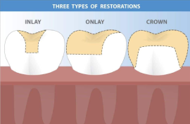 Best Dental Clinic keelkattalai