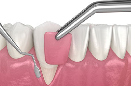 Best Dental Clinic Chennai
