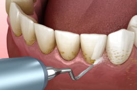 Top 10 Dental Hospital in Chennai