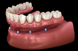  Paediatric Dentist in Chennai